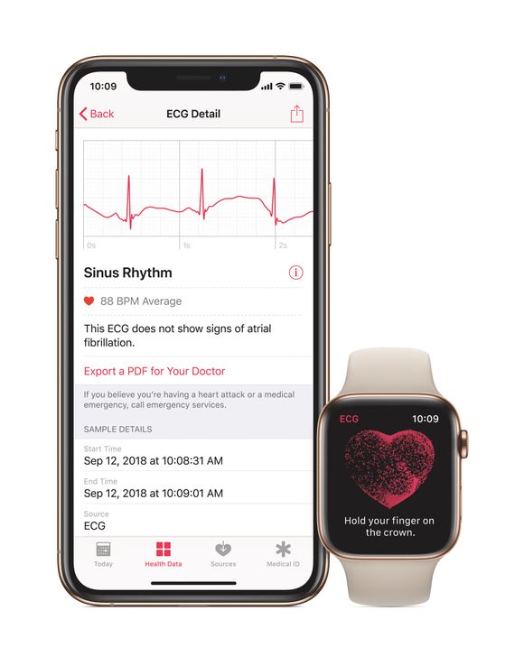Apple Watch 4_ECG App_AvantGuard